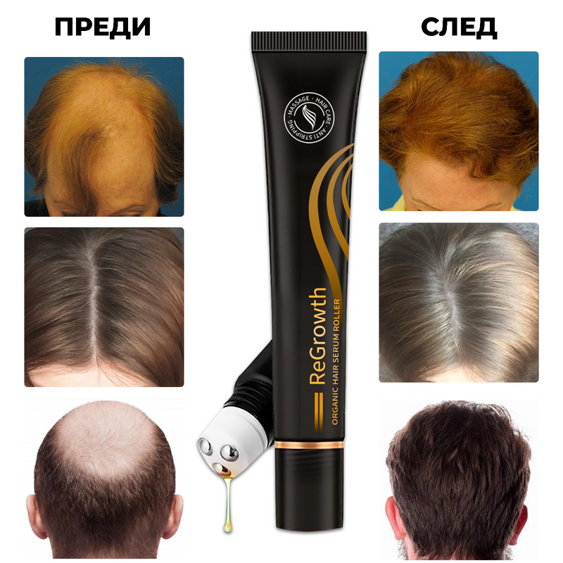 Серум за коса с ролер ReGrowth ( Купи 1+1 Безплатно! )